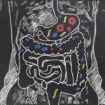 diet-and-microbiome-key-players-in-rising-gastric-cancer-cases