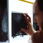 innovative-organ-chip-platform-enhances-chemotherapy-precision-for-esophageal-cancer