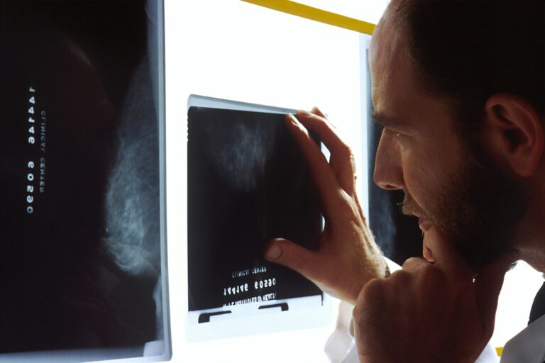 innovative-organ-chip-platform-enhances-chemotherapy-precision-for-esophageal-cancer
