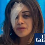 legal-battle-looms-over-alleged-police-force-at-sydney-protest