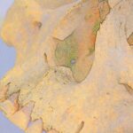 discovery-of-ancient-leprosy-strain-in-americas-challenges-historical-understanding