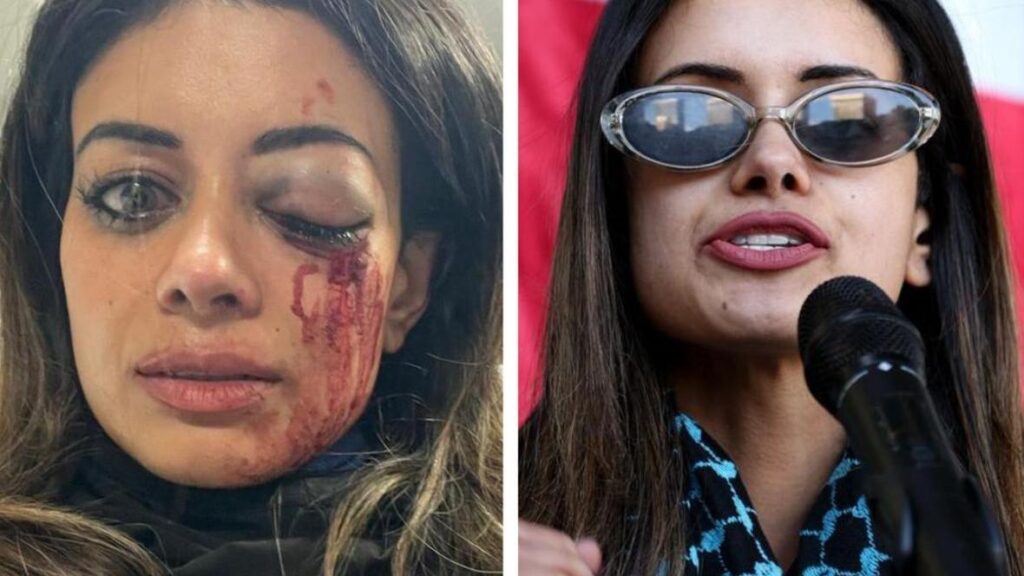 former-greens-candidate-criticizes-police-following-protest-injury