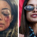former-greens-candidate-criticizes-police-following-protest-injury
