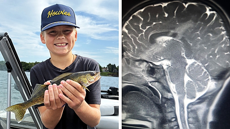 miracle-survival-9-year-old-boy-survives-arrow-through-brain