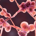 researchers-uncover-how-blood-protein-fuels-yeast-infections