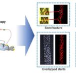 researchers-unveil-noninvasive-stent-imaging-using-light-and-sound