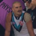sam-powell-pepper-suffers-severe-injury-in-match-against-lions