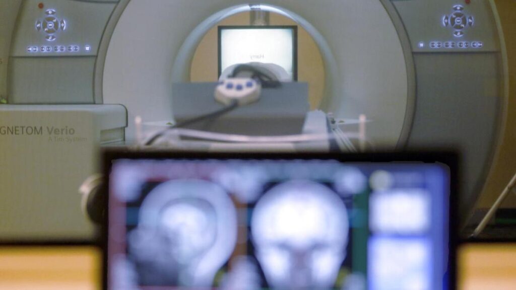 tragic-death-man-pulled-into-mri-machine-by-weight-chain