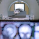 tragic-death-man-pulled-into-mri-machine-by-weight-chain