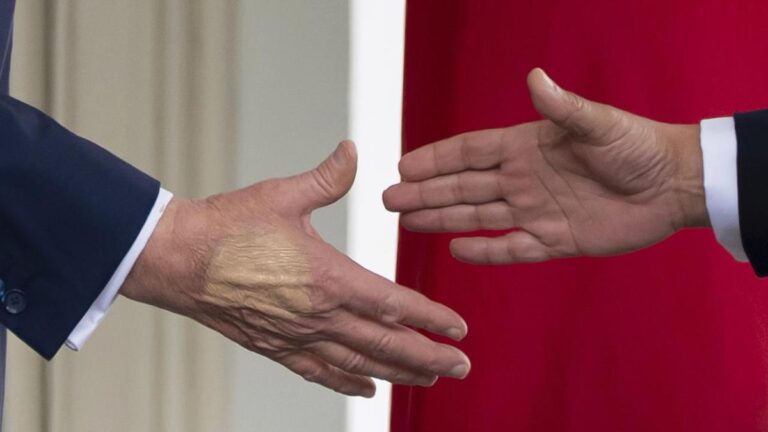 trump-s-doctors-confirm-leg-swelling-is-age-related-condition