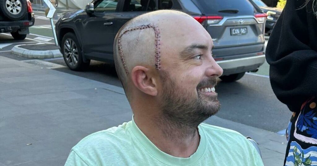 34-year-old-corey-fawcett-battles-terminal-brain-cancer