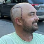 34-year-old-corey-fawcett-battles-terminal-brain-cancer
