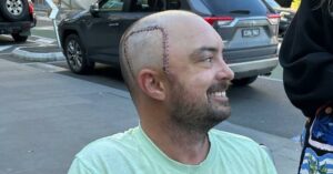34-year-old-corey-fawcett-battles-terminal-brain-cancer