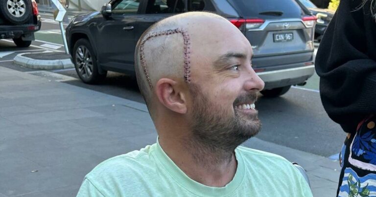34-year-old-corey-fawcett-battles-terminal-brain-cancer