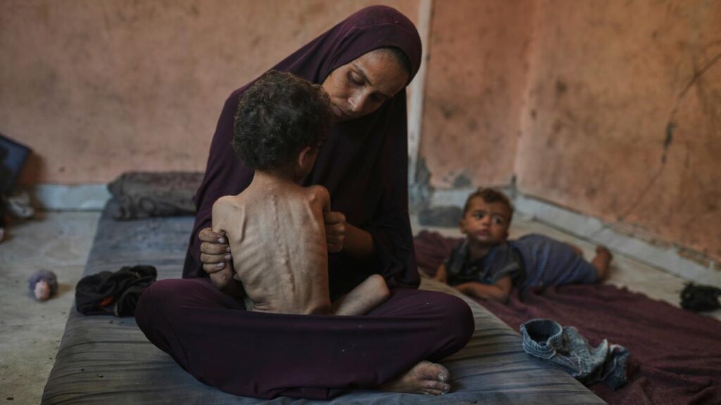 APTOPIX Mideast Wars Dying of Hunger