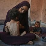 APTOPIX Mideast Wars Dying of Hunger