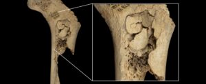 archaeological-discoveries-uncover-evidence-of-cannibalism-in-spain