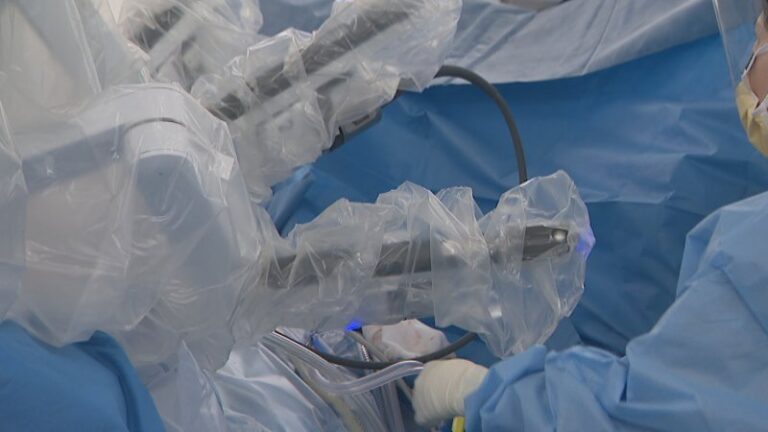 breakthrough-robot-surgery-offers-hope-for-endometriosis-patients