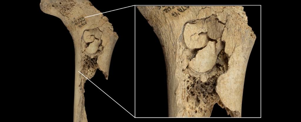 evidence-of-cannibalism-discovered-in-neolithic-spain