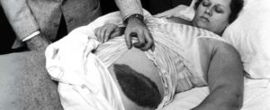 meteorite-strikes-alabama-woman-70-years-of-fascination