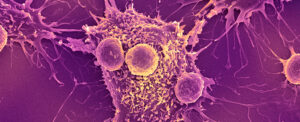 new-vaccine-eli-002-2p-shows-promise-against-pancreatic-colorectal-cancers