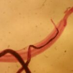 parasitic-worm-disables-pain-sensation-opening-path-for-new-treatments