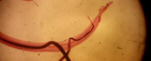 parasitic-worm-disables-pain-sensation-opening-path-for-new-treatments
