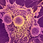 promising-new-vaccine-targets-deadly-cancers-clinical-trial-results-unveiled