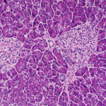 researchers-develop-sugar-cloak-to-protect-against-type-1-diabetes