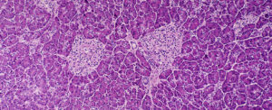 researchers-develop-sugar-cloak-to-protect-against-type-1-diabetes