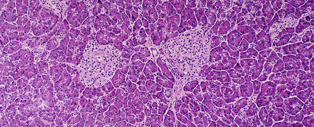 researchers-develop-sugar-cloak-to-protect-against-type-1-diabetes