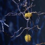 scientists-uncover-immune-cell-changes-linked-to-alzheimer-s-disease