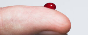 scientists-uncover-mechanism-of-young-blood-rejuvenating-skin-cells