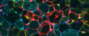 scientists-uncover-mechanism-to-convert-fat-into-energy