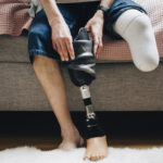 study-challenges-understanding-of-phantom-limb-sensations
