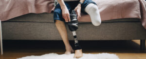 study-challenges-understanding-of-phantom-limb-sensations
