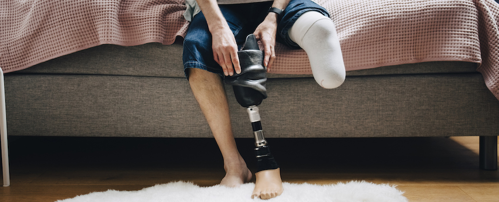 study-challenges-understanding-of-phantom-limb-sensations
