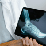 understanding-calcium-levels-key-insights-into-bone-health