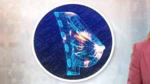 ai-mammogram-machine-revolutionizes-heart-disease-detection-for-women