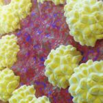 australia-faces-surge-in-stis-kirby-institute-reports-alarming-trends