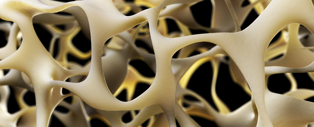breakthrough-discovery-could-transform-osteoporosis-treatment