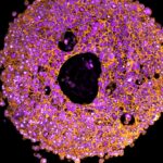 researchers-develop-3d-printed-mini-placentas-to-study-pregnancy-complications
