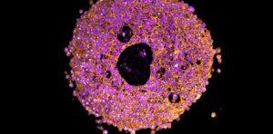 researchers-develop-3d-printed-mini-placentas-to-study-pregnancy-complications