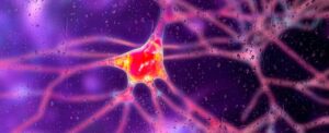 researchers-trial-groundbreaking-gene-therapy-to-combat-huntington-s-disease