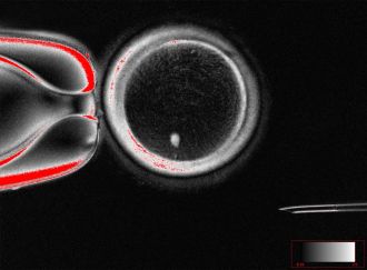 scientists-create-fertilizable-human-eggs-from-skin-cells