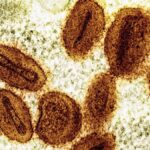 who-declares-mpox-no-longer-an-international-health-emergency