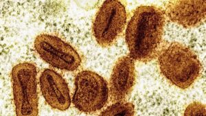 who-declares-mpox-no-longer-an-international-health-emergency