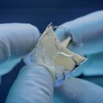 anteris-technologies-secures-39m-in-urgent-capital-raise