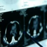 australian-study-reveals-breastfeeding-lowers-breast-cancer-risk