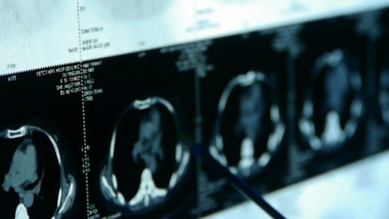 australian-study-reveals-breastfeeding-lowers-breast-cancer-risk